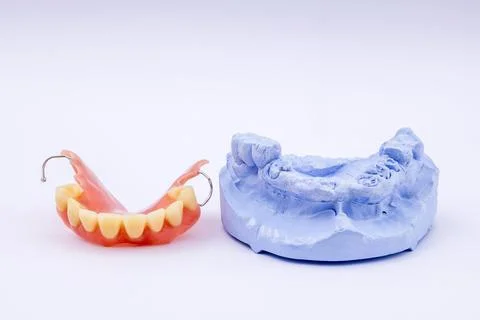 Removable denture of an upper jaw denture denture dentist dental impression Stock Photos