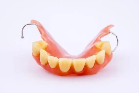 Removable denture of an upper jaw denture dental prosthesis dentist Stock Photos