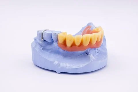 Removable denture of an upper jaw denture denture dentist dental impression Stock Photos