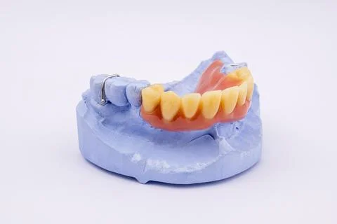 Removable denture of an upper jaw denture denture dentist dental impression Stock Photos