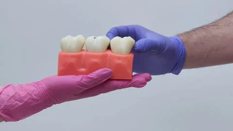 Removable Tooth Anatomy Model Demonstration in Gloves Stock Footage 333550497