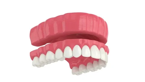 Removable traditional denture installation Stock Footage