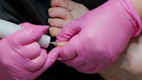 Removal of the keratinized layer from the nails using Electric Nail Drill Stock Footage 239640189
