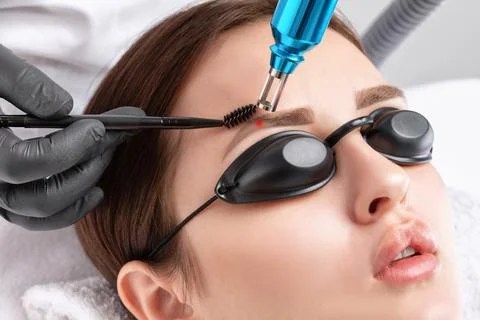 Removal of permanent makeup on the eyebrows of a woman.Carbon face peeling in Stock Photos