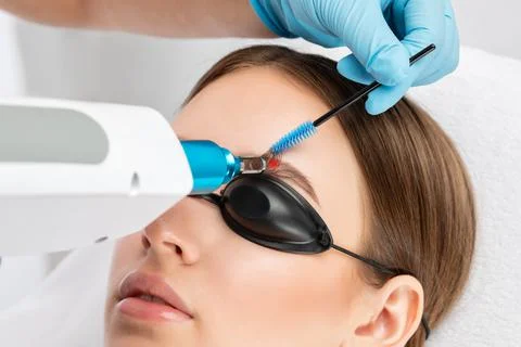 Removal of permanent makeup on the eyebrows of a woman.Carbon face peeling in Stock Photos