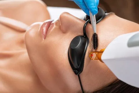 Removal of permanent makeup on the eyebrows of a woman.Carbon face peeling in Stock Photos