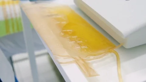 Removal of plasma from the blood Stock Footage 82615822