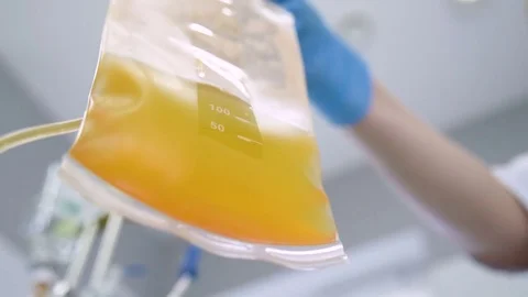 Removal of plasma from the blood Stock Footage 82615859