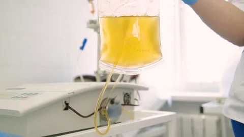 Removal of plasma from the blood Stock Footage 82615867