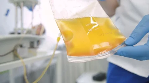 Removal of plasma from the blood Stock Footage 82615879