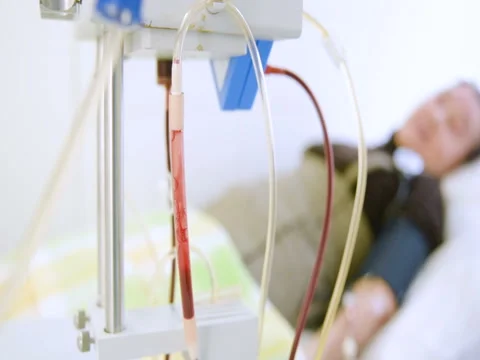 Removal of plasma from the blood Stock Footage 82616002