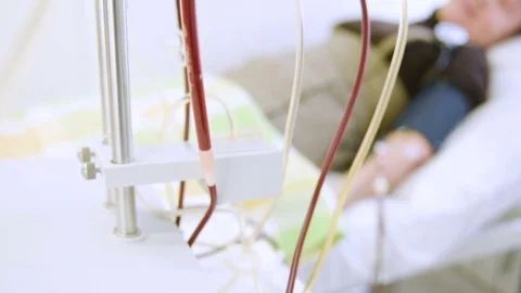 Removal of plasma from the blood Stock Footage 82616014