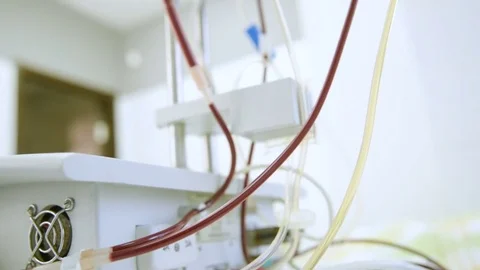Removal of plasma from the blood Stock Footage 82616047