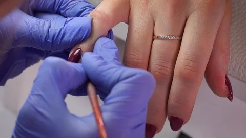 Removal is small using a cotton pad Stock Footage 103830887