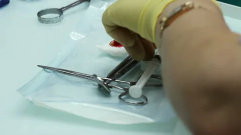 The removal of the tooth 库存影片 62711818