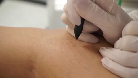 Removal of vessels Stock Footage 72541111