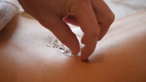 Remove from the back patch with cotton wool in the blood from the bite of a Stock Footage 85795596