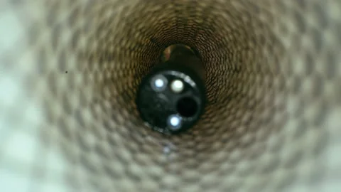 Remove the endoscope from the esophagus. Stock Footage 159660122