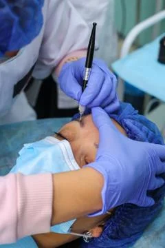 Remove microblasting old makeup. Stock Photos