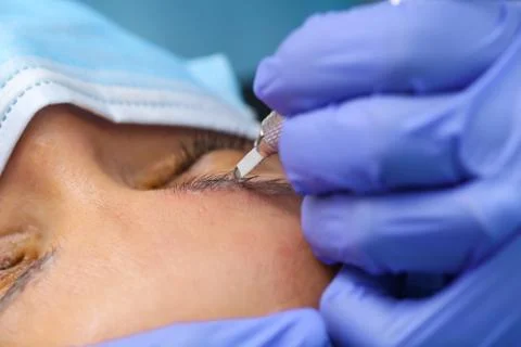 Remove microblasting old makeup. Stock Photos