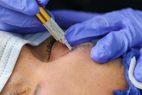 Remove microblasting old makeup. Stock Photos