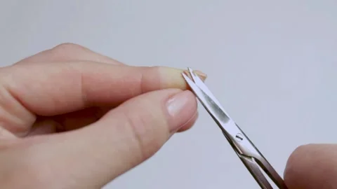 Remove the torn edges of the wound with scissors. Stock Footage 232096614