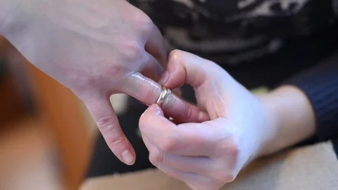 Removes the ring from the woman's hands swollen finger with oil lubricated Video stock 104175296