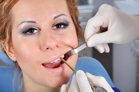 Removes the tooth Foto stock