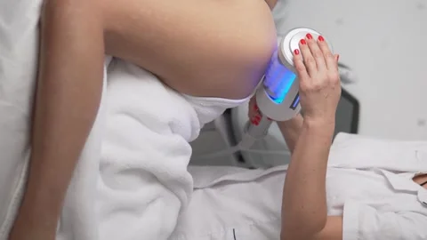 Removing fat from a woman's thigh, vertical video Stock Footage 295861179