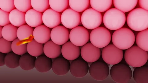 Removing inflammatory acne Video stock 208130450