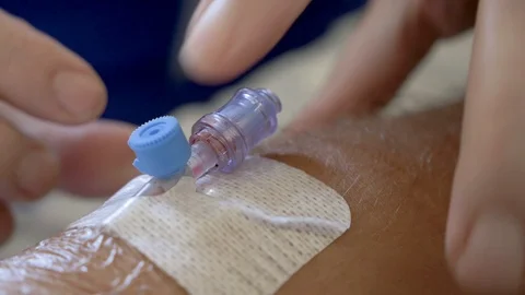 Removing intravenous drip from arm Stock Footage