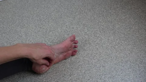 Removing large blister calluses from the heel, blisters on the foot Stock Footage 287130848