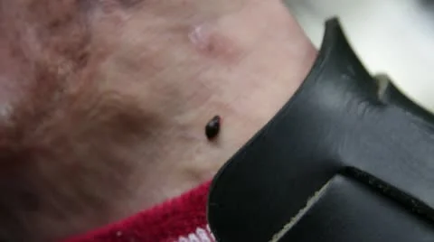 Removing leech in the rainforest Stock Footage 11199030