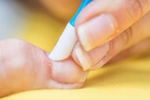 Removing old cuticle on a nail Stock Photos