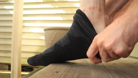 Removing Sock, Examining Flea Bites Vídeo Stock 108413786