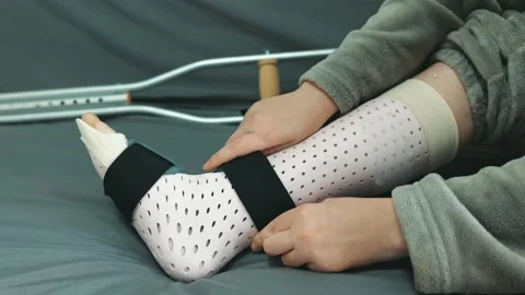 Removing a splint from the leg and preparing for movement Stock Footage 332830445