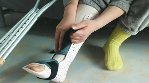 Removing a splint from the leg and preparing for movement Stock Footage 332830462