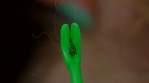 Removing a tick from a dog with a hook Stock Footage 136222440