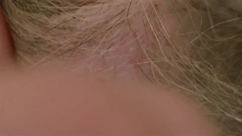 Removing a tick from a dog with a hook Stock Footage 136222500