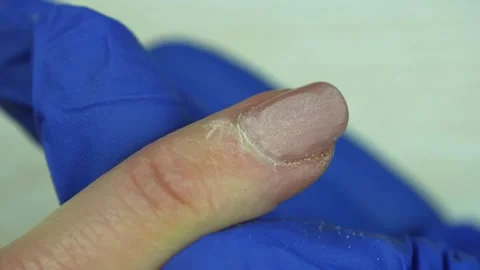 Removing the upper layer of the nail coating with nail file Stock Footage 241147085