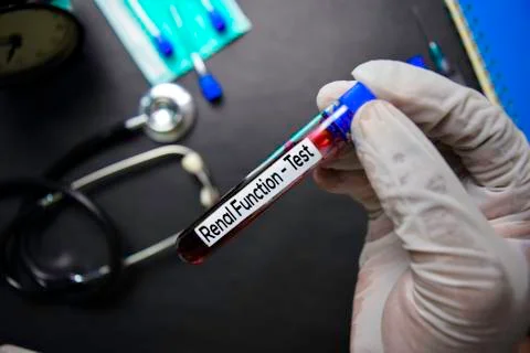 Renal Function - Test with blood sample. Top view Stock Photos