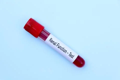 Renal function test to look for abnormalities from blood Stockfoto's