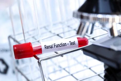 Renal function test to look for abnormalities from blood Stockfoto's