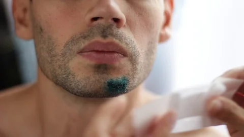 Replace the bandage on the wound on his face. Bandage of a torn wound on the Stock Footage 90911590