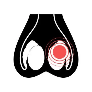 Reproductive system concept イラスト素材