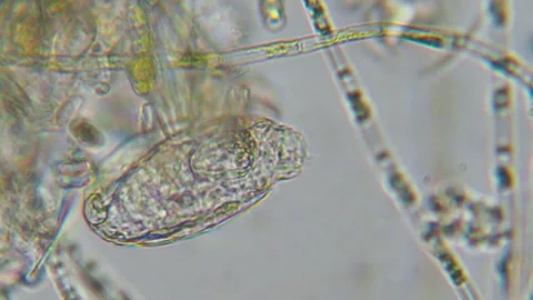 Research Scientists Unicellular Organisms. Soil Microorganisms Under Micros.. Stock Footage 315701640