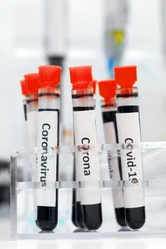 Research of virus in the lab. Stock Photos