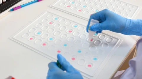 Researcher bacteriological or genetic laboratory in rubber gloves makes a blood Stock Footage 98005091