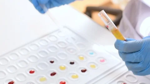 Researcher bacteriological or genetic laboratory in rubber gloves makes a blood Stock Footage 98005122