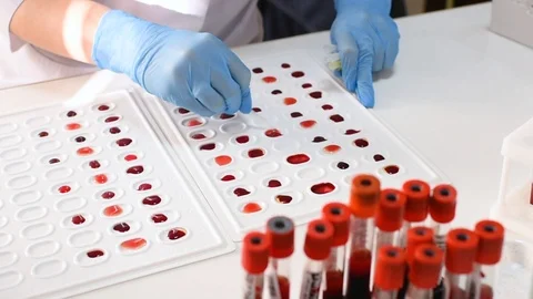 Researcher bacteriological or genetic laboratory in rubber gloves makes a blood Stock Footage 98005152